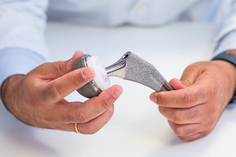 est ce qu une prothese de hanche peut bouger dr thomas stevignon chirurgien orthopediste specialiste hanche chirurgie orthopedique paris